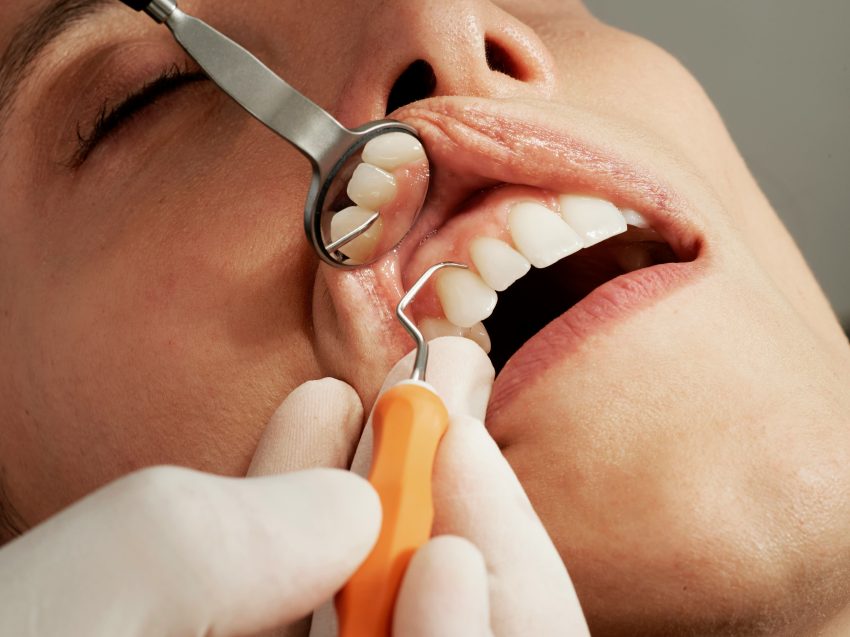 Consistent dental check up is one of the best effective tips for healthy teeth.